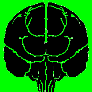 脳_mask_s.png